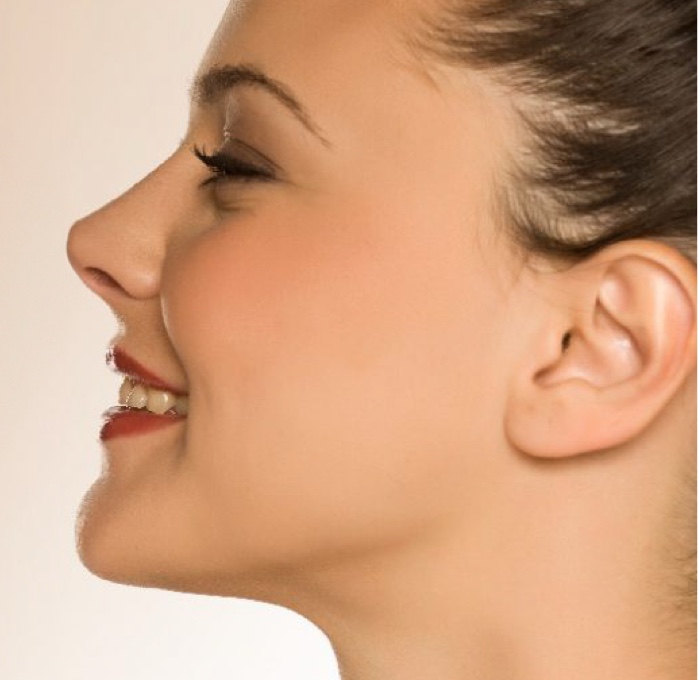 Rinoplastia ultrasónica