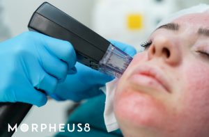 Tratamiento Morpheus Cliniem Madrid elimina flacidez