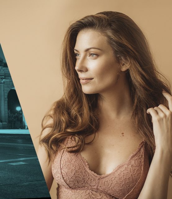 caída pelo alopecia Madrid Cliniem