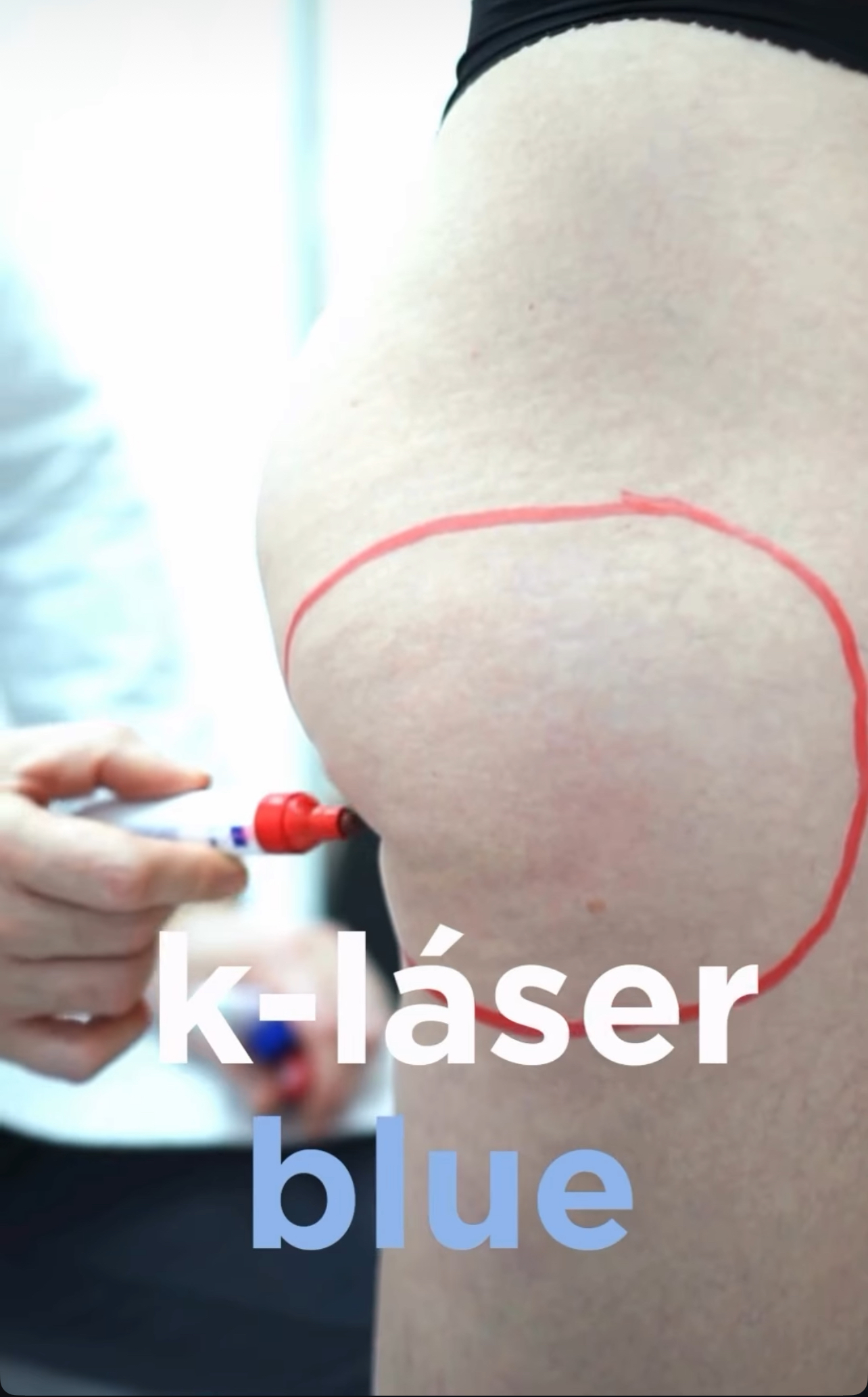 K-laser Blue Cliniem