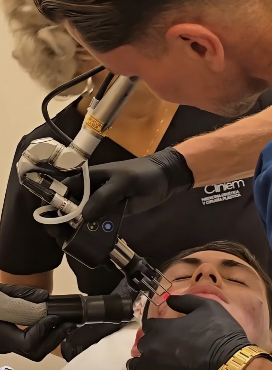 Acné juvenil: La importancia de tratarlo a tiempo y eliminar sus cicatrices