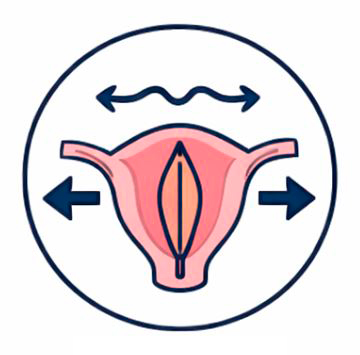Atrofia vaginal
